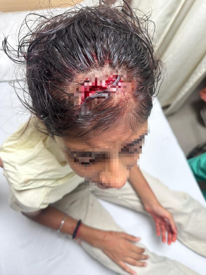 Fear grips high-rise societies as falling debris injures a girl in Noida’s Amrapali Platinum Society Fear grips high-rise societies as falling debris injures a girl in Noida’s Amrapali Platinum Society